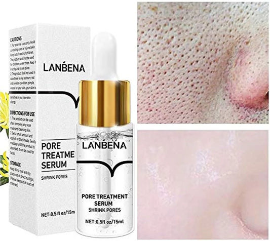 LANBENA Pore Solution Serum (Original) – موثوق لعلاج المسام وتنقية البشرة