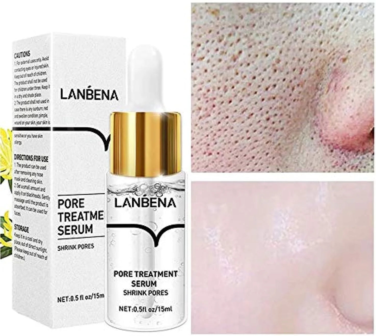 LANBENA Pore Solution Serum (Original) – موثوق لعلاج المسام وتنقية البشرة