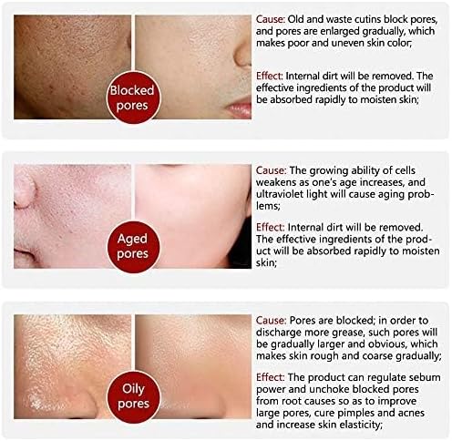 LANBENA Pore Solution Serum (Original) – موثوق لعلاج المسام وتنقية البشرة